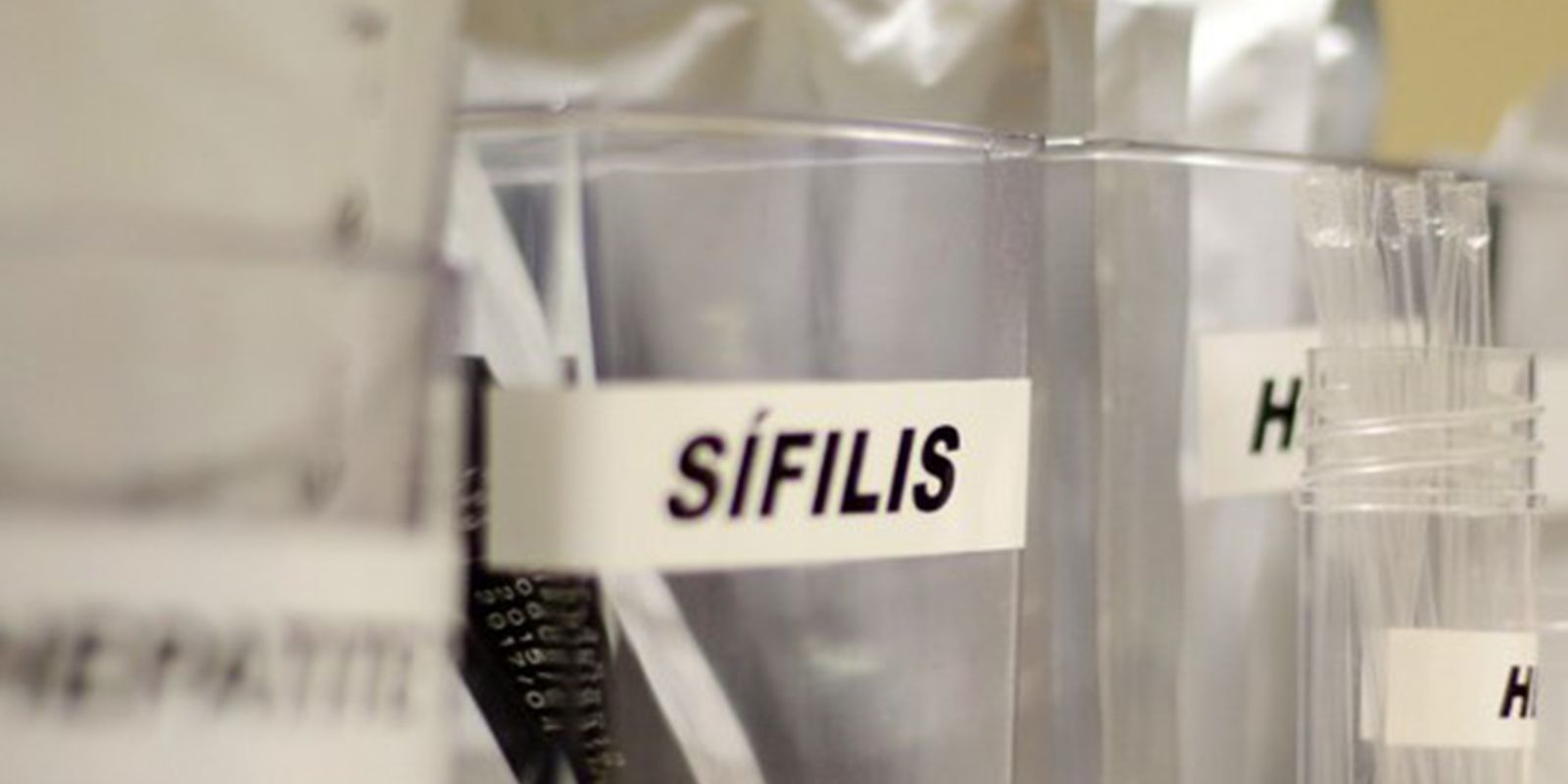 Centro de SP tem testagem grátis de HIV, hepatite, síflis e gonorreia