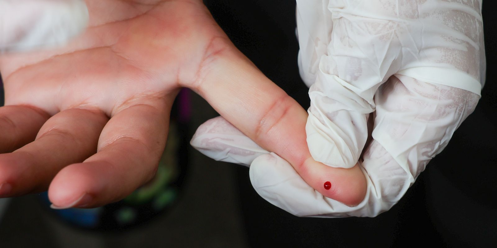  SUS passa a oferecer teste rápido de dengue