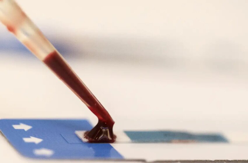  Estudo inédito da Fiocruz pode ampliar prevenção de HIV entre jovens