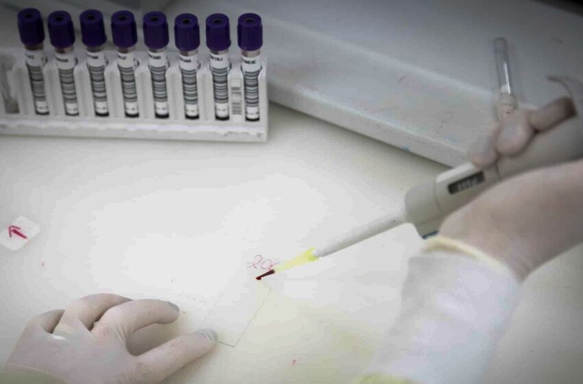  Exames descartam ebola em paciente de São Paulo; meningite confirmada