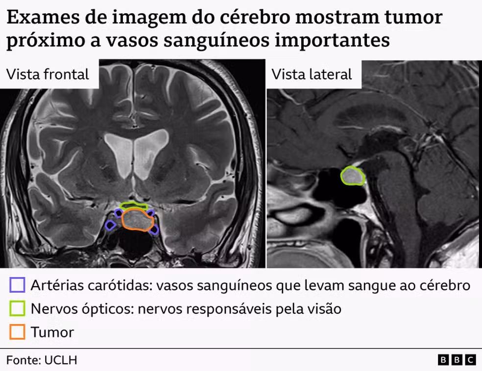 Exames de imagem do cérebro.