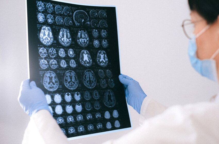  Células de defesa do cérebro podem ajudar a proteger contra o Alzheimer, aponta estudo