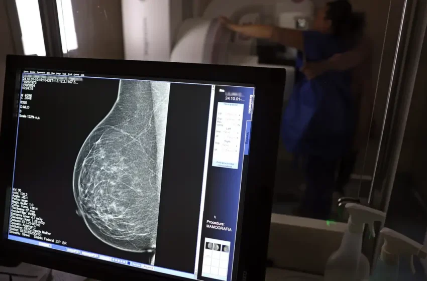  Mamografia digital: médicos orientam como evitar a recusa do exame